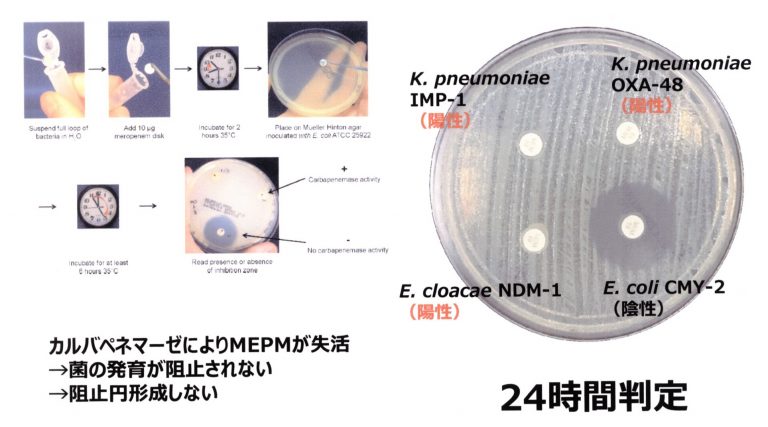 図4 検出の画像
